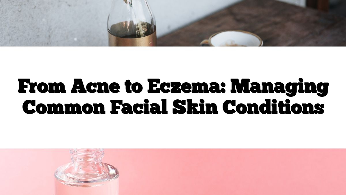 From Acne to Eczema: Managing Common Facial Skin Conditions