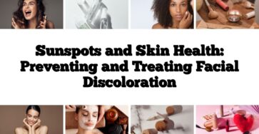 Sunspots and Skin Health: Preventing and Treating Facial Discoloration