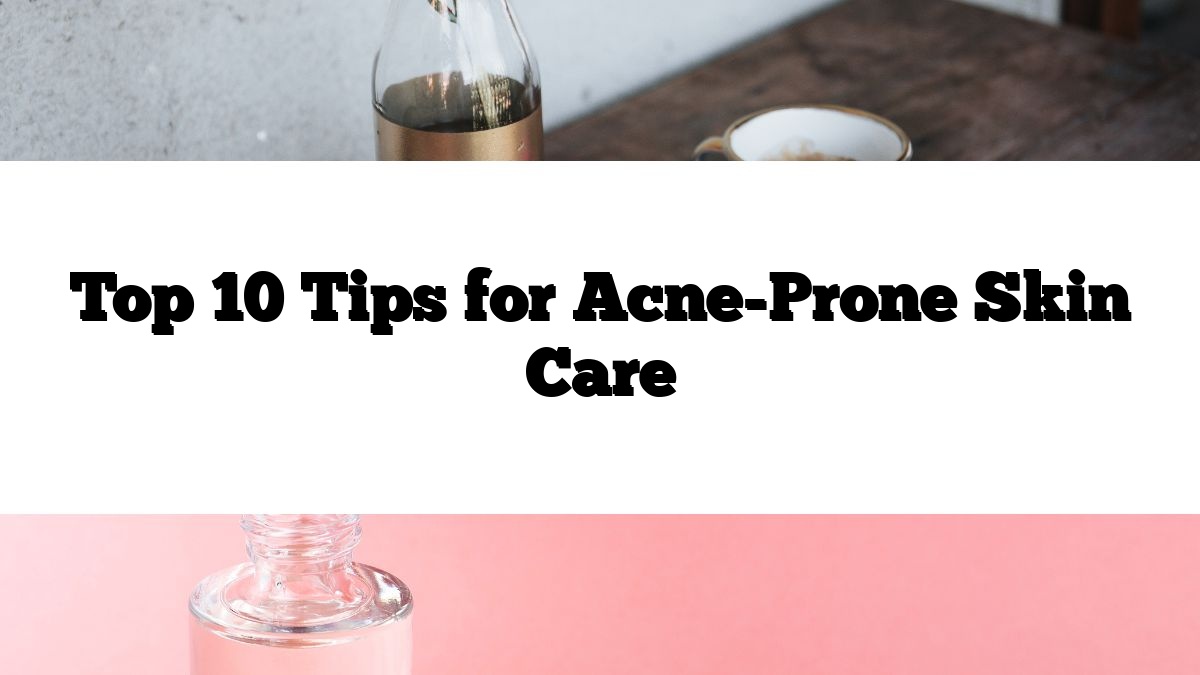 Top 10 Tips for Acne-Prone Skin Care